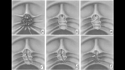 Методические рекомендации Эндоскопическая папиллэктомия 2022.